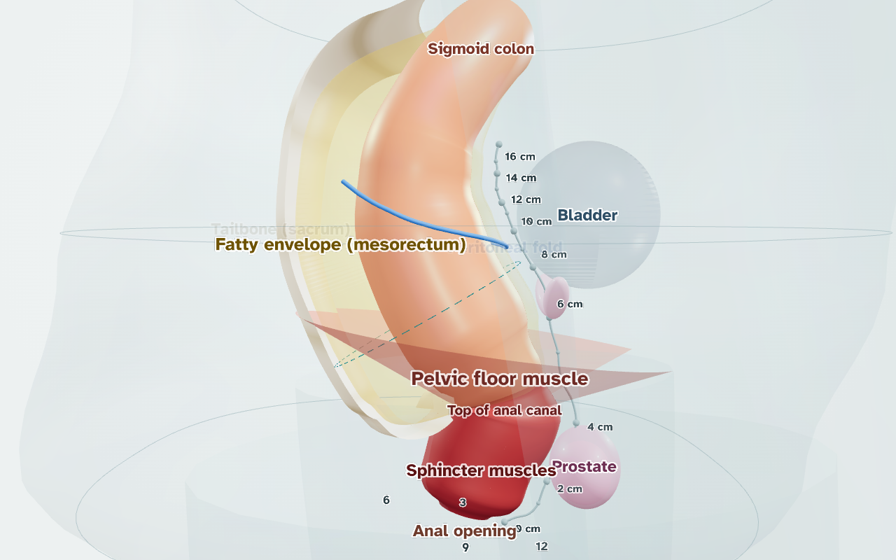 The rectal cancer explorer: a 3D model of the rectum with the fatty envelope around it, the pelvic floor, sphincter muscles, bladder and prostate, each labelled.